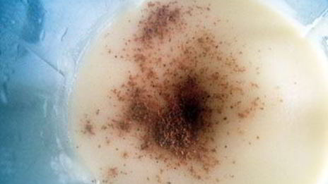 картофельно-ореховые фрикадельки